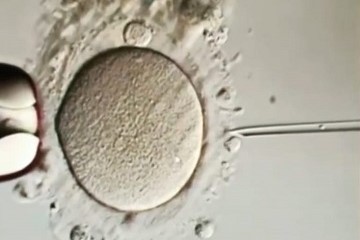 OP. DR. MELTEM ANTALYALI, meltem antalyalı, dr meltem antalyalı, Doğum, Sezeryen, IVF, Tüp Bebek, İnseminasyon, Aşılama, Genital Estetik, Jinekolojik Ameliyatlar, Laporoskopik Ameliyatlar, Kadın Hastalıkları Tedavisi, Kozmetik Jinekolojik Operasyonlar